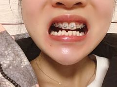 -美酷口腔牙齿矫正(江桥万达店)