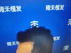 -雍禾植发全国连锁