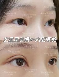 -Yestar重庆艺星医疗美容医院