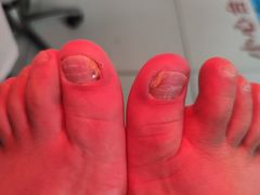 -新甲连锁灰指甲·甲沟炎·鸡眼(黑龙江路店)