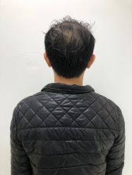 -发饰美男士增发补发假发定制店