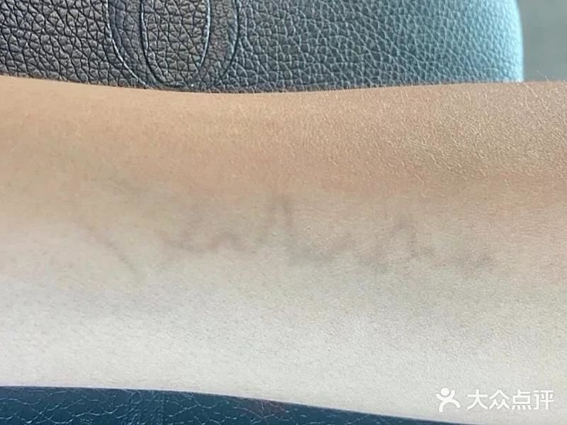 皮秒洗纹身