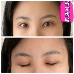 -素美医疗美容·西南眼鼻整形·修复基地