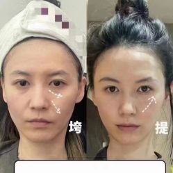 -LUNA皮相美·骨相美高级美感