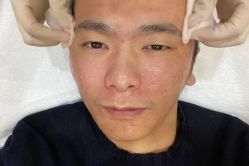 -厦门美莱整形美容医院