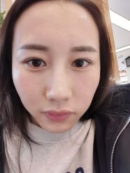 体验后-天津伊美尔医疗整形美容专科医院