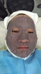 -KS科逆美肤祛痘