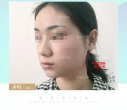 -圣嘉新医疗美容医院