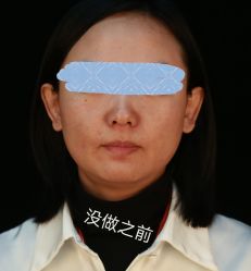 -八大处整形