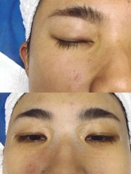 体验前-禾美嘉医疗美容