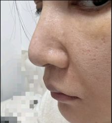 -深圳米兰柏羽医疗美容医院