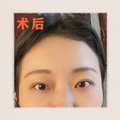 -素美医疗美容·西南眼鼻整形·修复基地
