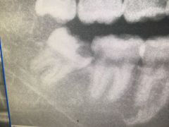 -上海市杨浦区牙病防治所