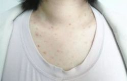 -SKINIST丽铂医疗美容