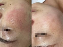 -美愈美肤MEIYU SKIN