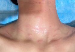 -上海玫瑰医疗美容医院