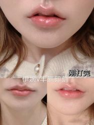 -上海漾颜医疗美容