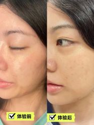 -杭州米兰柏羽医疗美容医院