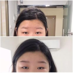 -Doris多里斯半永久纹眉·SMP纹发·发际线