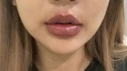 -海涛医疗美容·面部抗衰·注射美鼻