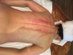 悦容国际美容(望京店皇冠店)-爱莎国际美容