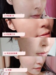 -大华韩艺整形美容医院