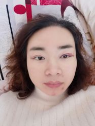 体验后-禾美嘉医疗美容