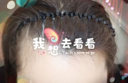 -大麦微针植发全国连锁