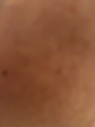 体验后-BR光电保养