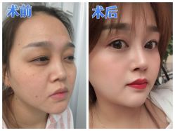 -素美医疗美容·西南眼鼻整形·修复基地