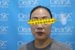 -洁铭新加坡医美