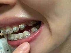 -柏乐口腔(南宁总院)