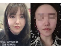-和颜一美轻医美连锁