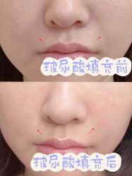 -深圳艺星医疗美容医院