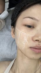 点击看大图 -Yestar艺星整形美容医院