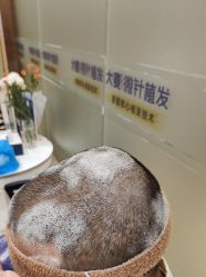 -大麦微针植发全国连锁