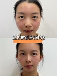 -Yestar重庆艺星医疗美容医院