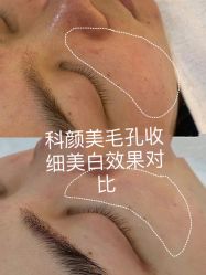 -美肤盾祛痘·问题肌头疗管理中心