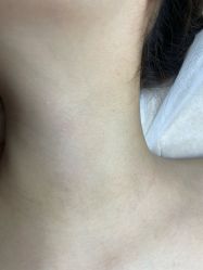 -清疣美疣·痣·斑净肤中心