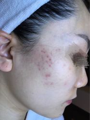 -皇族养心堂·净痘·修敏·御颜