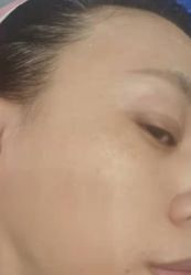体验前-坤如玛丽·医疗美容中心