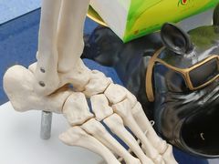 -Andrew指甲专科灰指甲·甲沟炎矫正·3D步态矫形鞋垫定制(上海法华镇路旗舰店)