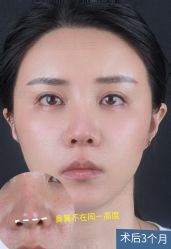 -北京米扬丽格医疗美容·联合丽格鼻整形中心