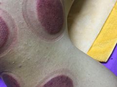 -沈师傅盲人按摩工作室(密三小区店)