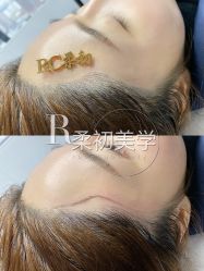 -RC半永久纹眉纹发际线