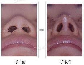 -CMS西美斯·美式医疗美容