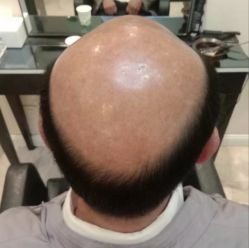 -唐风采假发补发定制