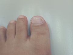 -新甲连锁灰指甲·甲沟炎·鸡眼(黑龙江路店)