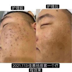 -佳慕·痘痘·问题肌管理中心