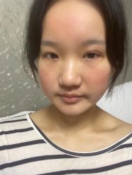 -广东韩妃整形外科医院